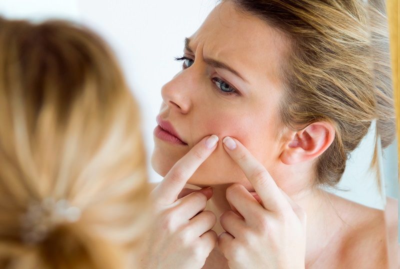 tips para tratar el acne